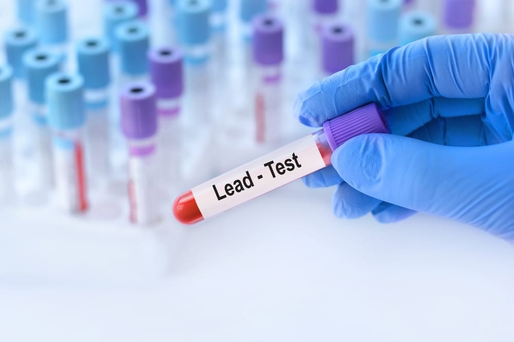 lead testing